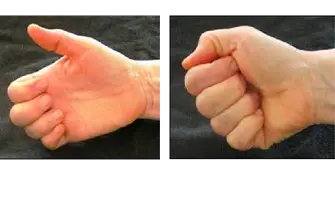 Håndartrose - øvelse 2.png